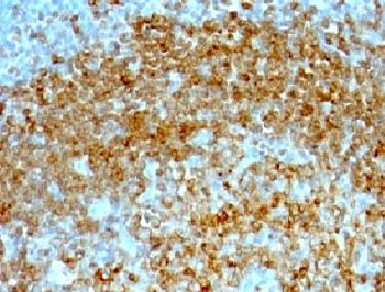 CD74 / CLIP Antibody