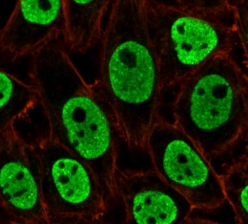 Nuclear Antigen Antibody