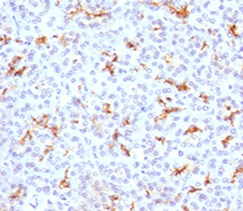 CFTR Antibody / Cystic Fibrosis Transmembrane Regulator