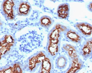 CFTR Antibody / Cystic Fibrosis Transmembrane Regulator