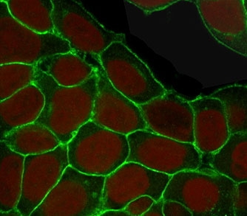EpCAM Antibody / Extracellular domain
