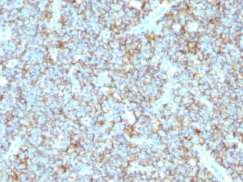 CD99 Antibody