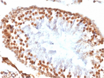 WT1 Antibody / Wilms Tumor 1