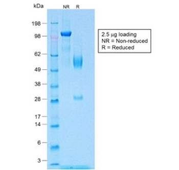 WT1 Antibody / Wilms Tumor 1