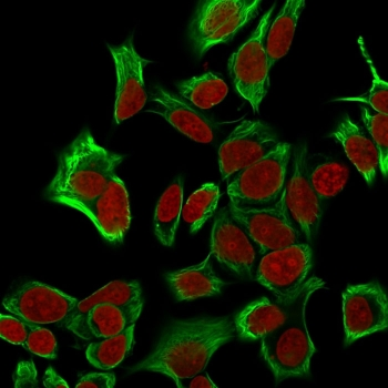 EpCAM Antibody