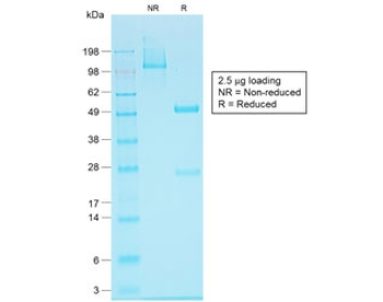 EpCAM Antibody