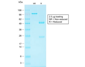 EpCAM Antibody