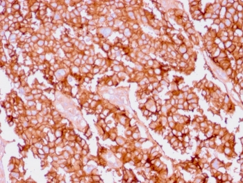 EpCAM Antibody