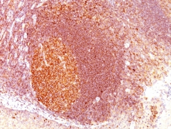 MALT1 Antibody