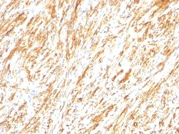 GFAP Antibody / Glial Fibrillary Acidic Protein
