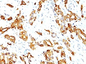 HSP27 Antibody / HSPB1