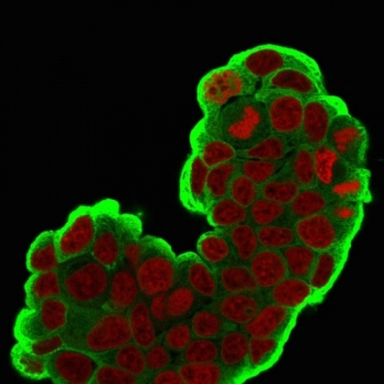 HSP27 Antibody / HSPB1