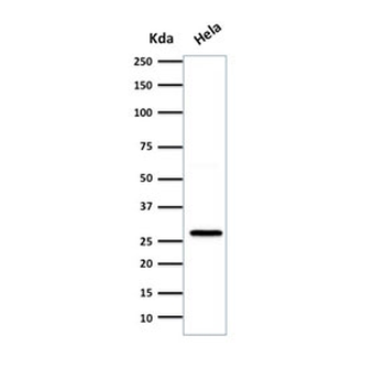 HSP27 Antibody / HSPB1