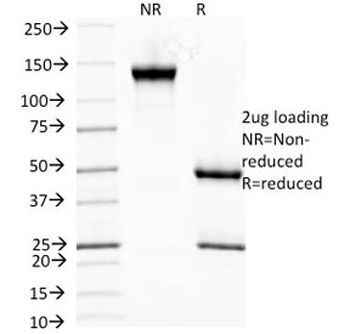 HSP27 Antibody / HSPB1