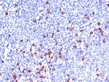 Kappa Light Chain Antibody