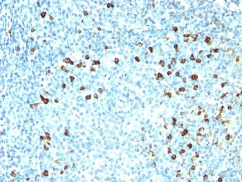 Kappa Antibody
