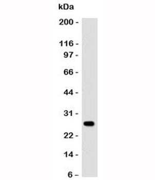 Lambda Light Chain Antibody / Lambda Antibody