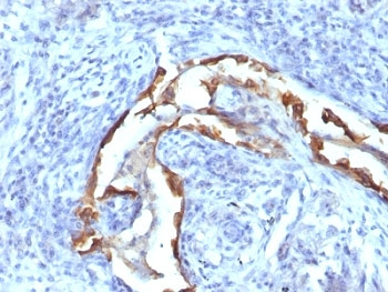 KRT8 Antibody / Cytokeratin 8