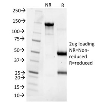 KRT8 Antibody / Cytokeratin 8