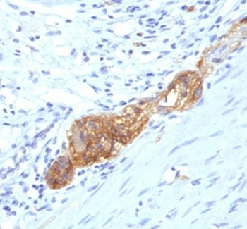 CD56 Antibody