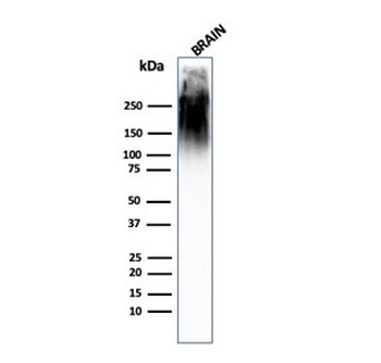 Neurofilament Antibody (-Heavy) / NF-H / NEFH
