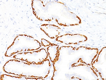 Cytokeratin 14 Antibody / CK14 / KRT14