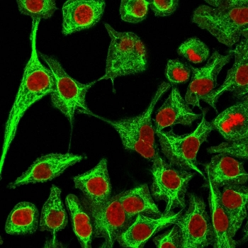 Cytokeratin 14 Antibody / CK14 / KRT14