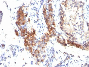 FOXP3 Antibody