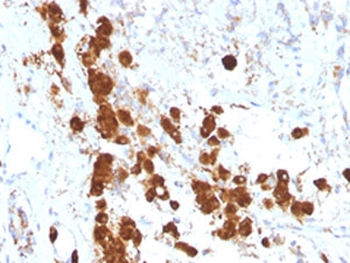ACTH Antibody / Synacthen
