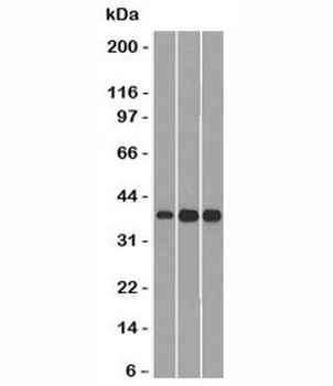 Cyclin D1 Antibody / CCND1