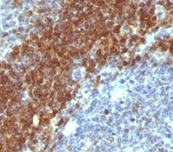 Bcl-2 Antibody