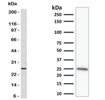 Bcl-2 Antibody