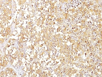 PMEL17 / Melanoma gp100 Antibody