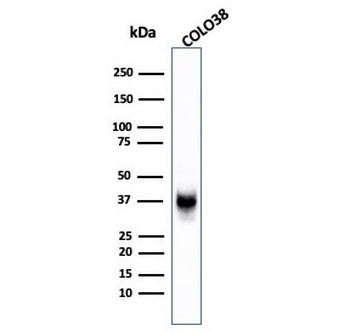PMEL17 / Melanoma gp100 Antibody