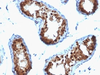 SUMO2/3 Antibody