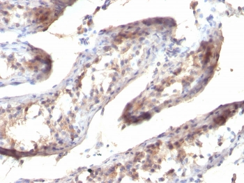 TGF alpha Antibody