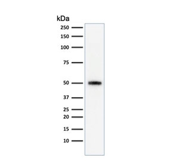 p53 Antibody / TP53