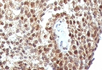 p53 Antibody / TP53