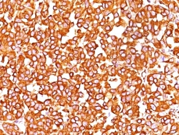 Vimentin Antibody