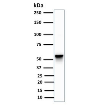 Vimentin Antibody