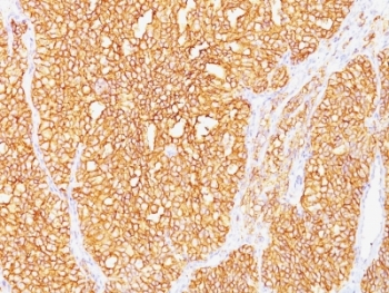 Carbonic Anhydrase IX Antibody