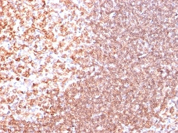 CD74 / CLIP Antibody