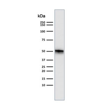 CD79a Antibody
