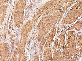 Muscle Specific Actin Antibody