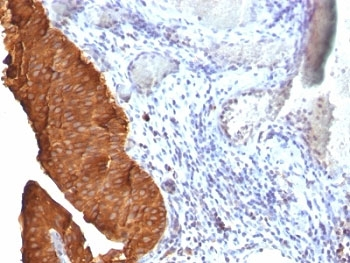 KRT19 Antibody / Cytokeratin 19