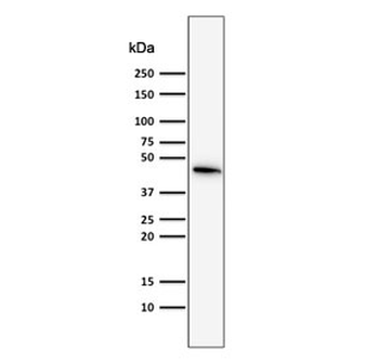 KRT19 Antibody / Cytokeratin 19
