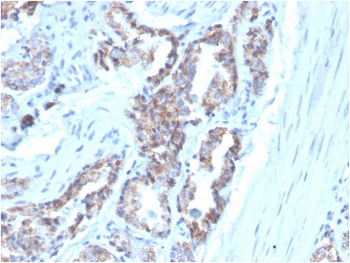 KRT7 Antibody / Cytokeratin 7