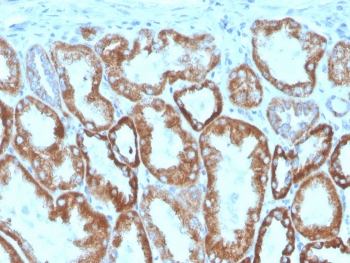 Interferon gamma Antibody / IFNG