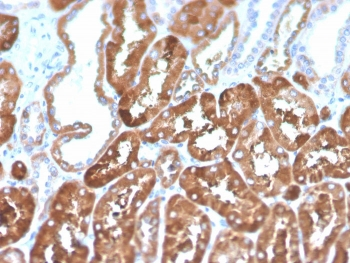FTL Antibody / Ferritin Light Chain