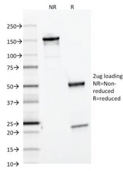 FTL Antibody / Ferritin Light Chain